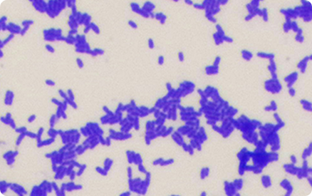 Bifidobacterium animalis subsp. lactis B420