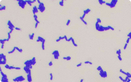 Bifidobacterium animalis subsp. lactis HN019