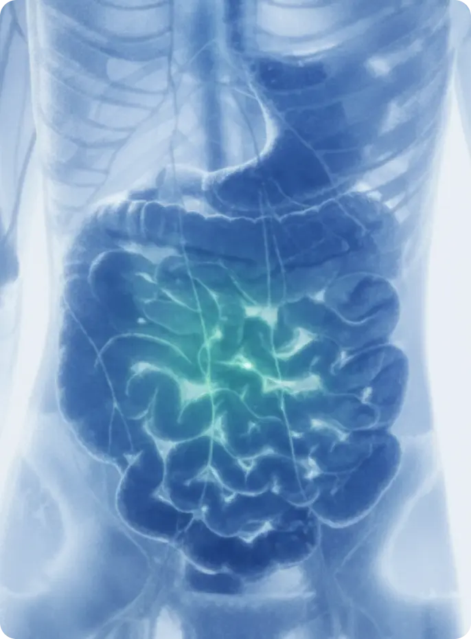 X-ray-like image of a human torso with intestines highlighted in green.